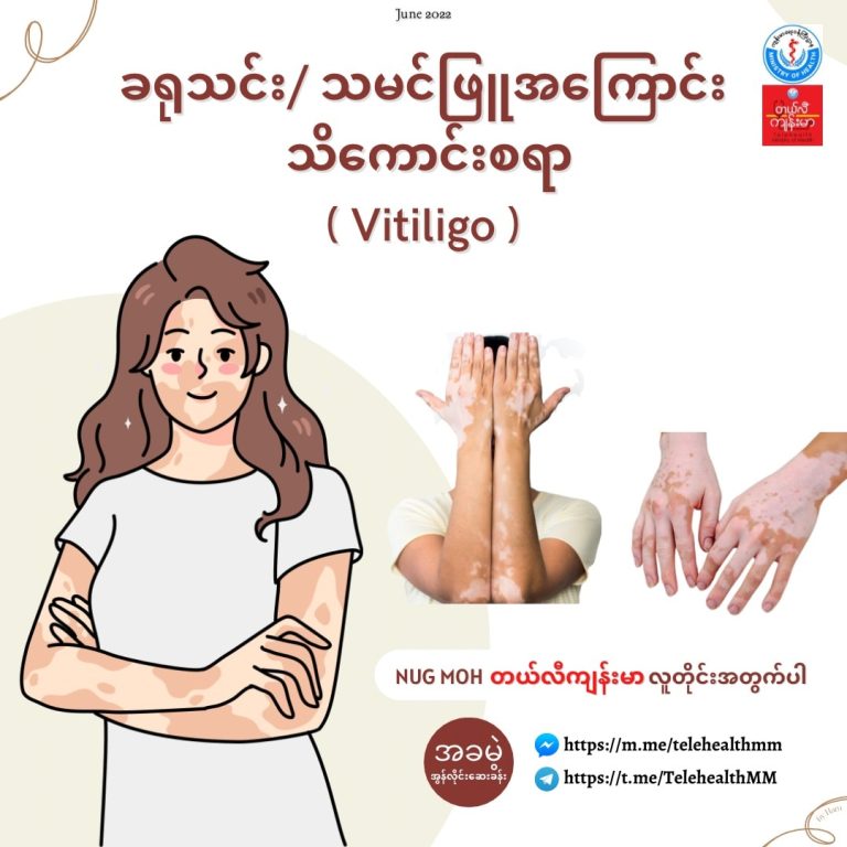 ခရုသင်း/သမင်ဖြူ အကြောင်း သိကောင်းစရာ Vitiligo ( June, 2022 )