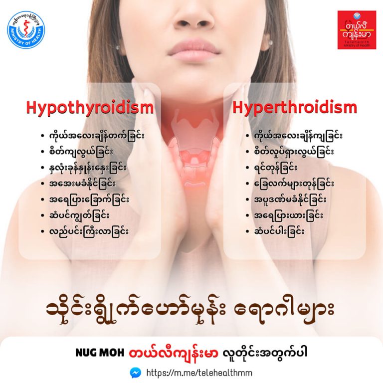 သိုင်းရွိုက်ဟော်မုန်းရောဂါများ Hypothyroidism and Hyperthyroidism (October, 2022)